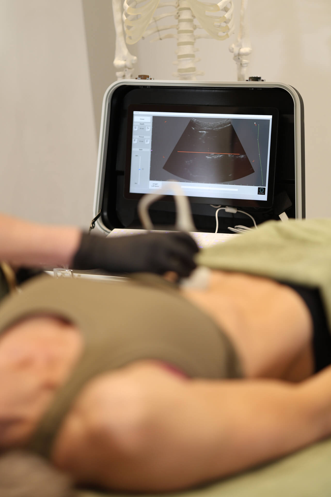 bone scan ravenstone wellness
