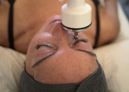 mesotherapy treatment ravenstone wellness mesotherapy treatment ravenstone wellness